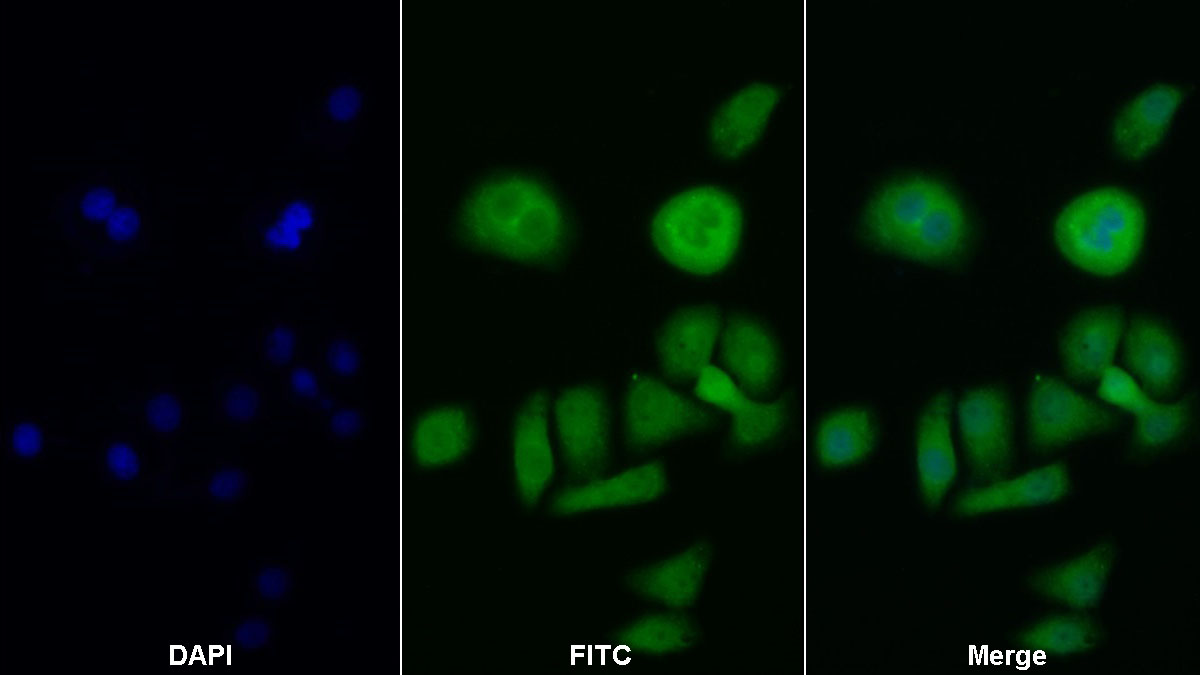 Polyclonal Antibody to Phosphoinositide-3-Kinase Catalytic Beta Polypeptide (PIK3Cb)