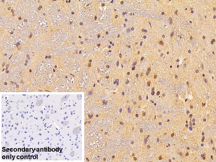 Polyclonal Antibody to Phosphoinositide-3-Kinase Catalytic Beta Polypeptide (PIK3Cb)