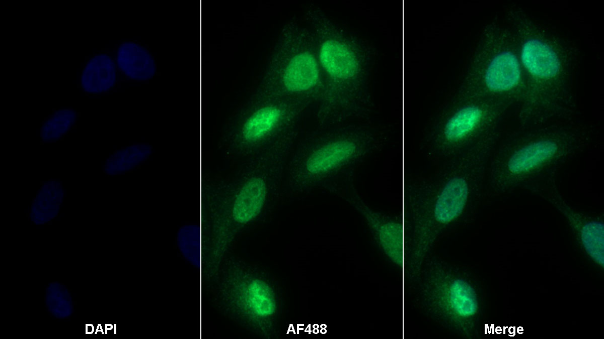 Polyclonal Antibody to Phosphoinositide-3-Kinase Catalytic Beta Polypeptide (PIK3Cb)