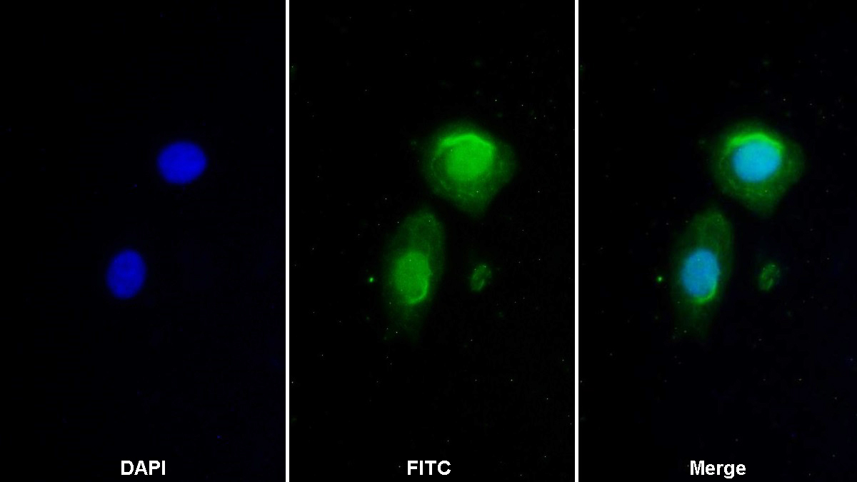 Polyclonal Antibody to Phosphoinositide-3-Kinase Catalytic Beta Polypeptide (PIK3Cb)