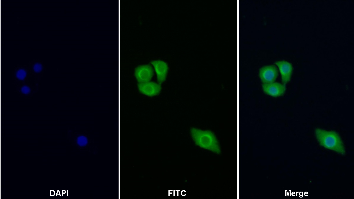 Polyclonal Antibody to Phosphoinositide-3-Kinase Catalytic Beta Polypeptide (PIK3Cb)