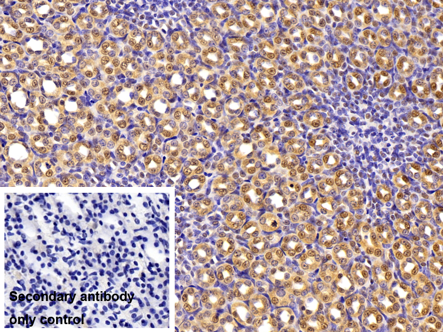 Polyclonal Antibody to Phosphoinositide-3-Kinase Catalytic Beta Polypeptide (PIK3Cb)