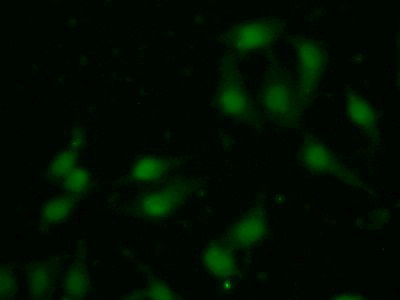 Polyclonal Antibody to Phosphoinositide-3-Kinase Catalytic Beta Polypeptide (PIK3Cb)