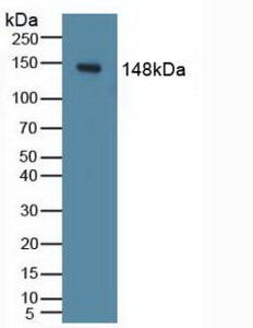 Polyclonal Antibody to Phosphoinositide-3-Kinase Catalytic Delta Polypeptide (PIK3Cd)