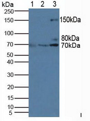 Polyclonal Antibody to Phosphoinositide-3-Kinase Adaptor Protein 1 (PIK3AP1)