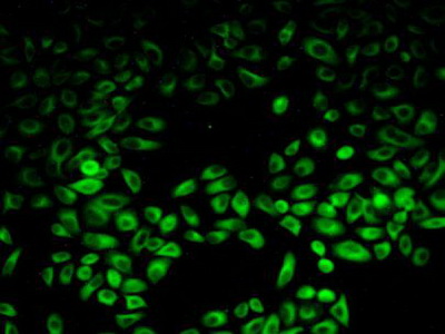 Polyclonal Antibody to Phosphoinositide-3-Kinase Adaptor Protein 1 (PIK3AP1)