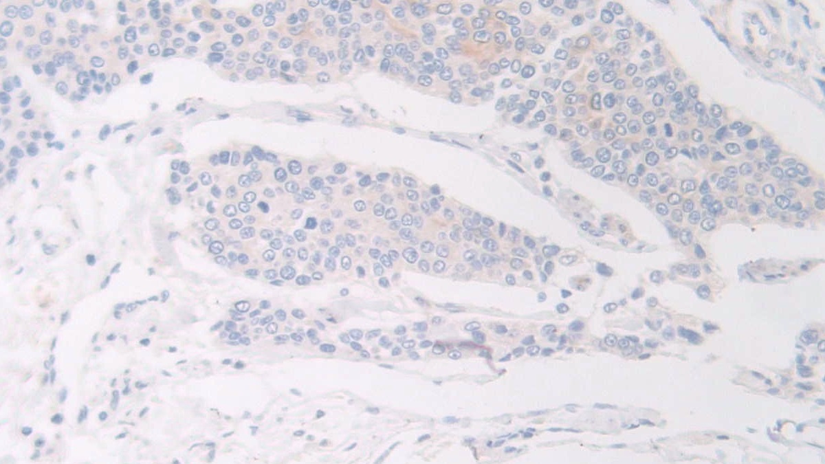 Polyclonal Antibody to Flightless I Homolog (FLII)