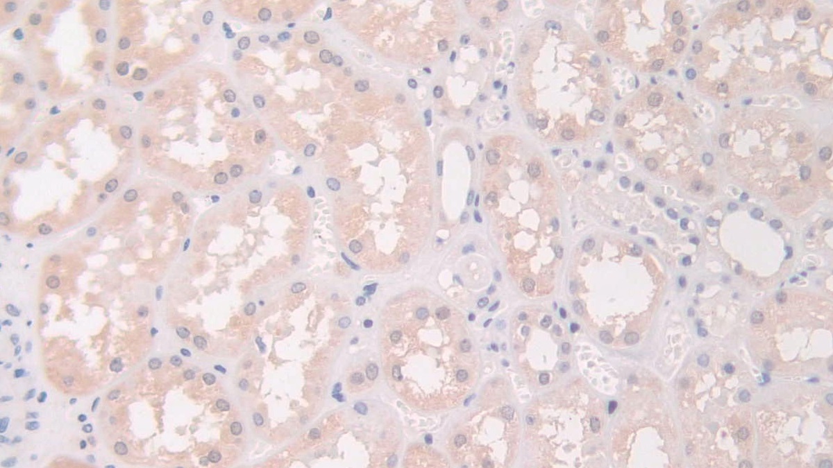 Polyclonal Antibody to Flightless I Homolog (FLII)