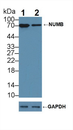 Polyclonal Antibody to Numb Homolog (NUMB)