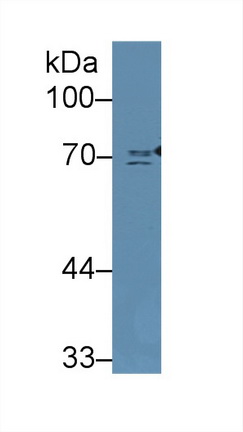 Polyclonal Antibody to Numb Homolog (NUMB)