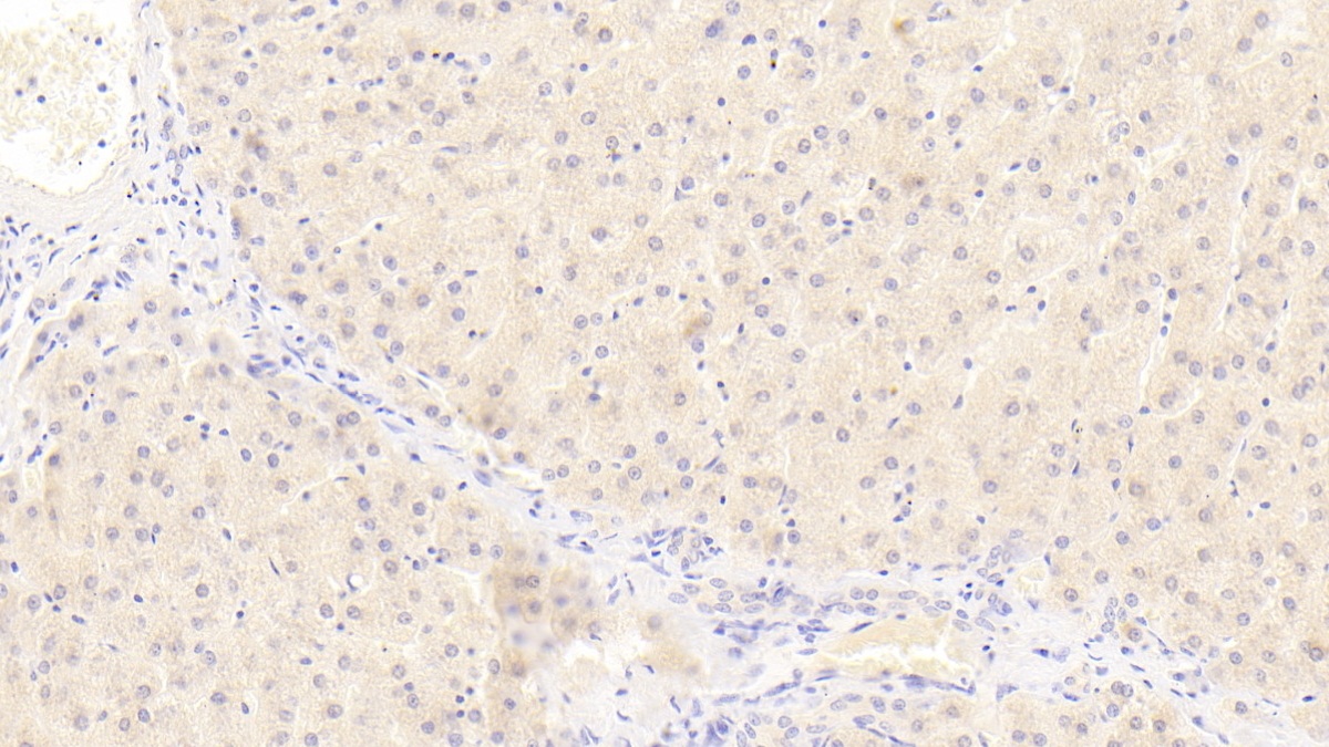 Polyclonal Antibody to Numb Homolog (NUMB)