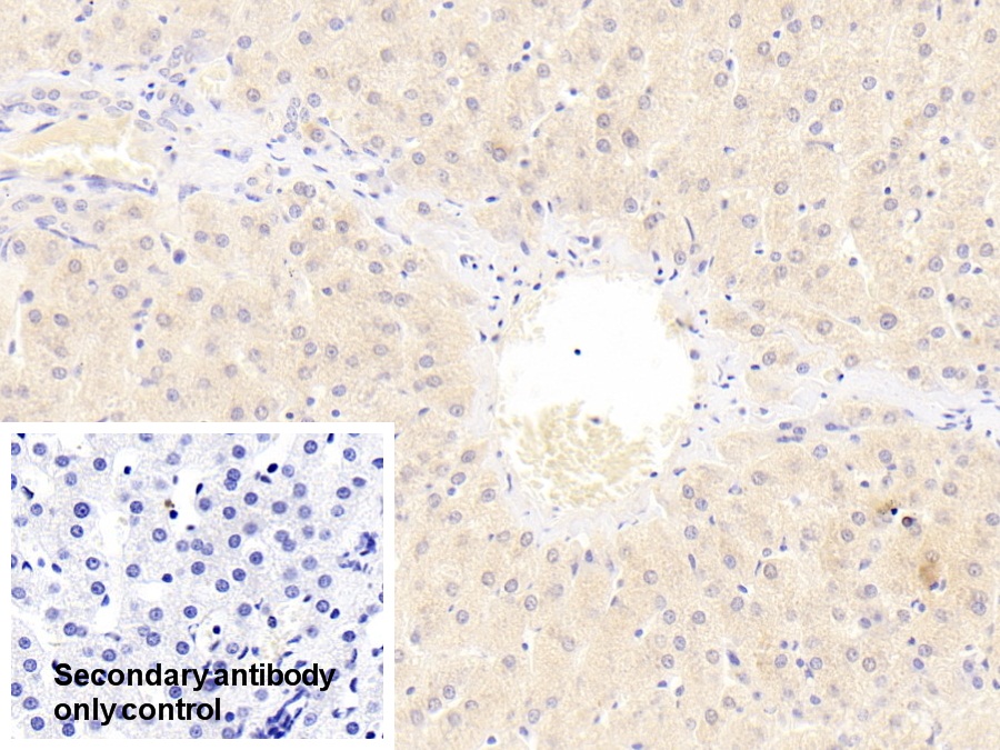 Polyclonal Antibody to Numb Homolog (NUMB)