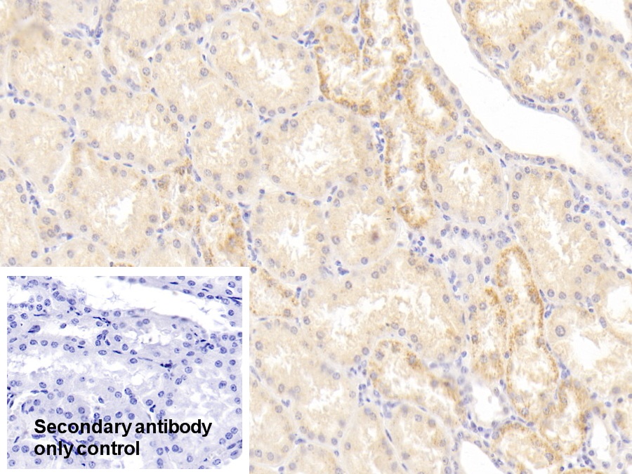 Polyclonal Antibody to Numb Homolog (NUMB)