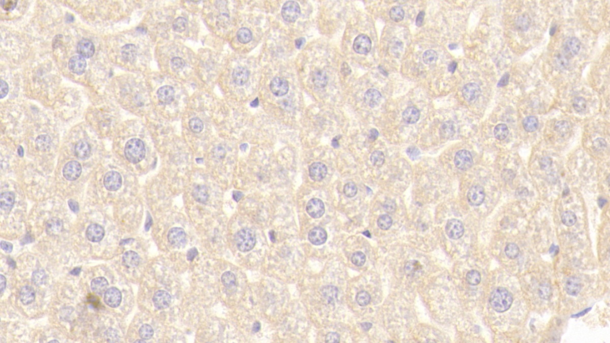 Polyclonal Antibody to Numb Homolog (NUMB)