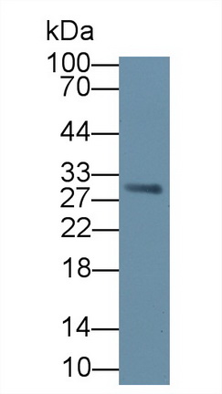 Polyclonal Antibody to V-Set Domain Containing T-Cell Activation Inhibitor 1 (VTCN1)