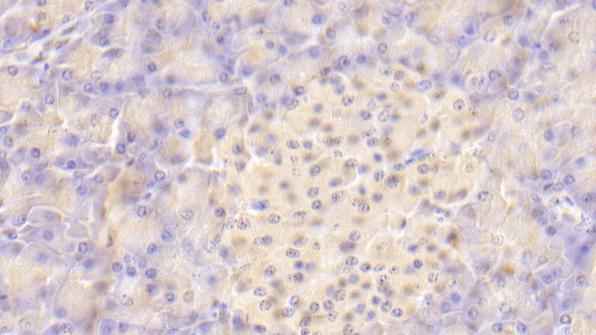 Polyclonal Antibody to V-Set Domain Containing T-Cell Activation Inhibitor 1 (VTCN1)