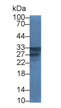 Polyclonal Antibody to V-Set Domain Containing T-Cell Activation Inhibitor 1 (VTCN1)