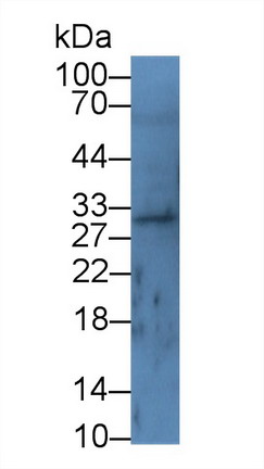 Polyclonal Antibody to V-Set Domain Containing T-Cell Activation Inhibitor 1 (VTCN1)