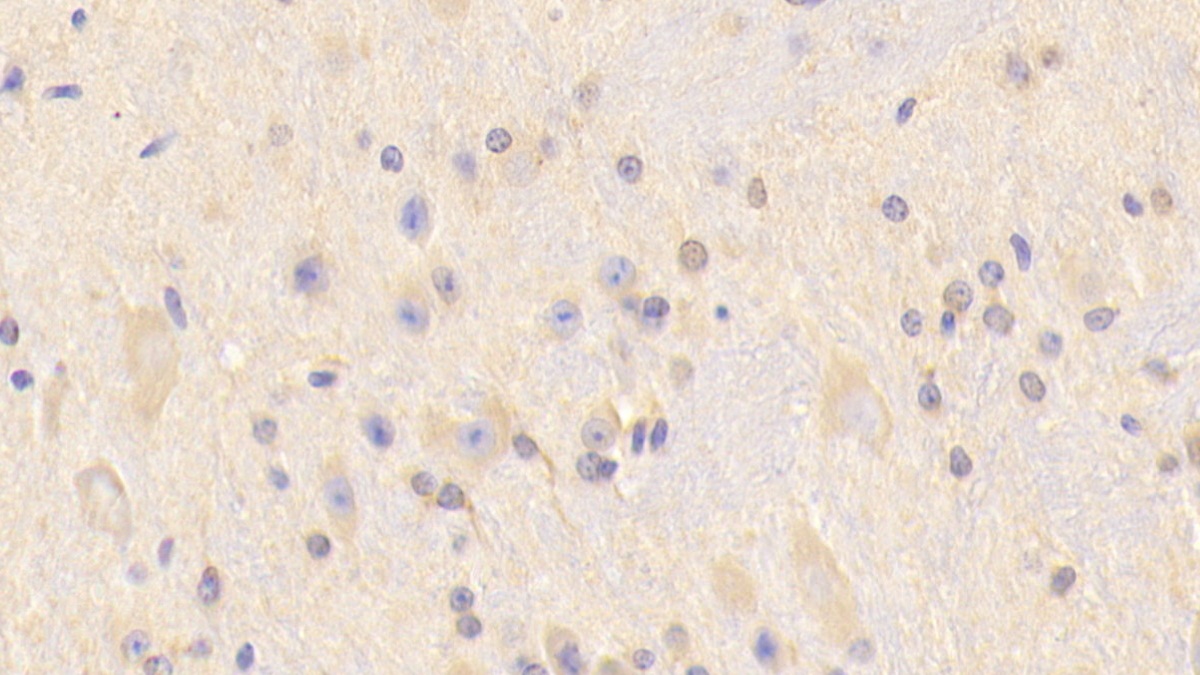 Polyclonal Antibody to Carnosine Synthase 1 (CARNS1)