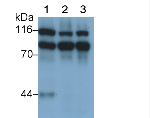 Polyclonal Antibody to Enhancer Of Zeste Homolog 2 (EZH2)