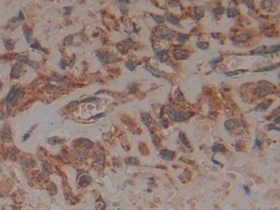 Polyclonal Antibody to Fas Associating Death Domain Containing Protein (FADD)