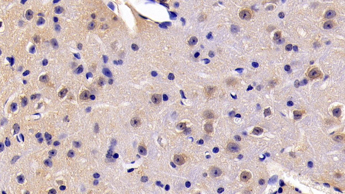 Polyclonal Antibody to Fas Associating Death Domain Containing Protein (FADD)