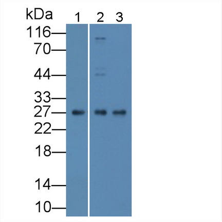 Polyclonal Antibody to Fas Associating Death Domain Containing Protein (FADD)