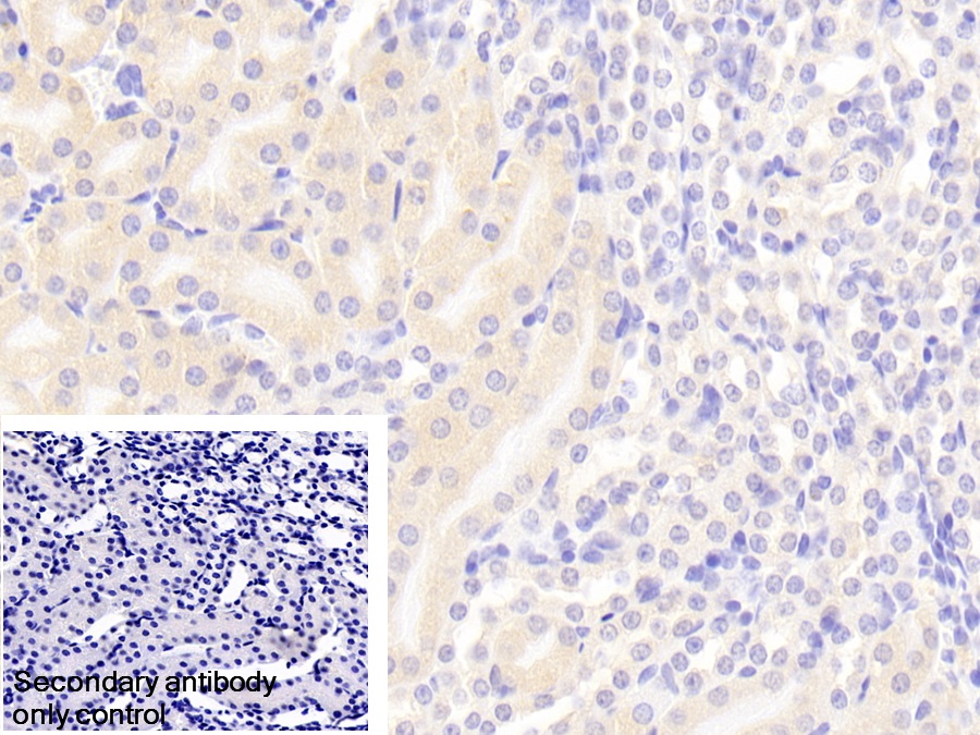 Polyclonal Antibody to Fas Associating Death Domain Containing Protein (FADD)