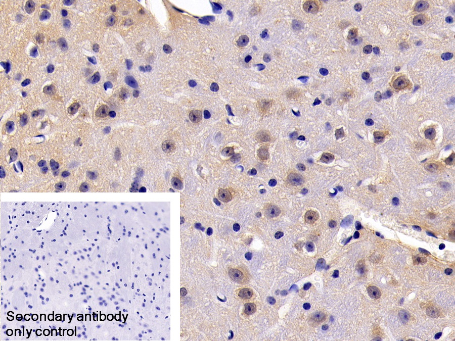 Polyclonal Antibody to Fas Associating Death Domain Containing Protein (FADD)