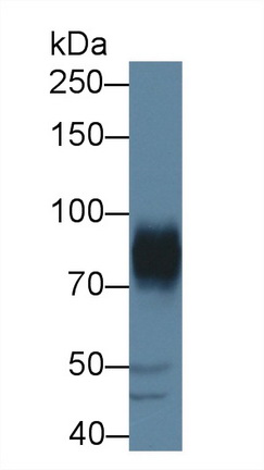 Polyclonal Antibody to A Disintegrin And Metalloprotease 22 (ADAM22)