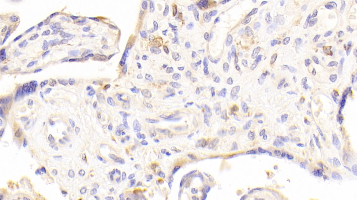 Polyclonal Antibody to C1q And Tumor Necrosis Factor Related Protein 1 (C1QTNF1)