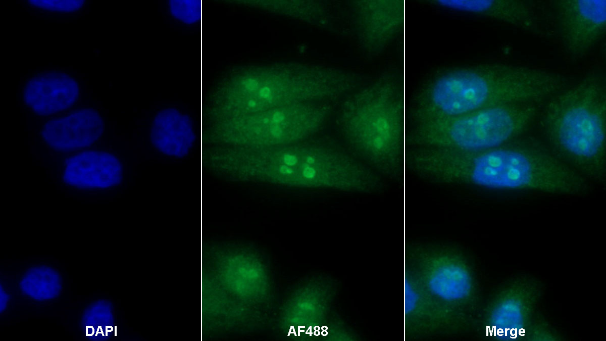 Polyclonal Antibody to Pescadillo Homolog 1 (PES1)