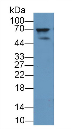 Polyclonal Antibody to Pescadillo Homolog 1 (PES1)