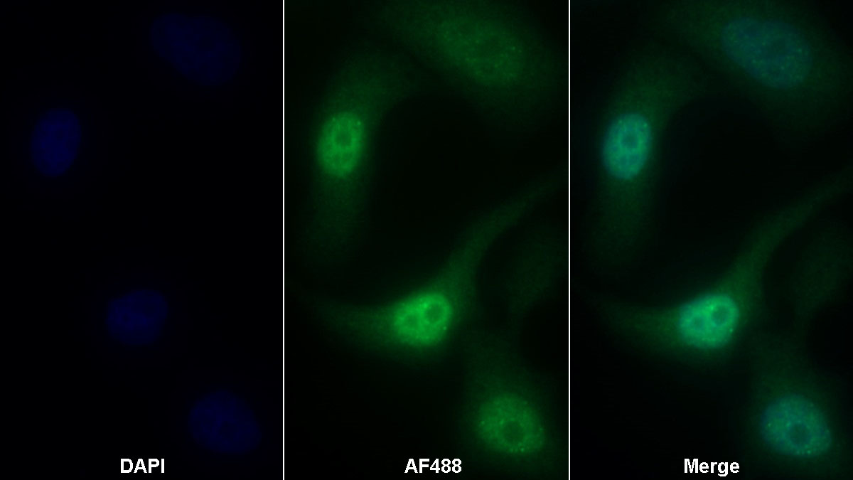 Polyclonal Antibody to Fanconi Anemia Complementation Group D2 (FANCD2)