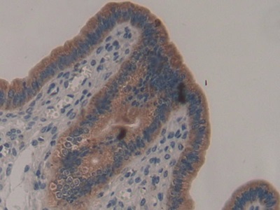 Polyclonal Antibody to A Disintegrin And Metalloproteinase With Thrombospondin 2 (ADAMTS2)