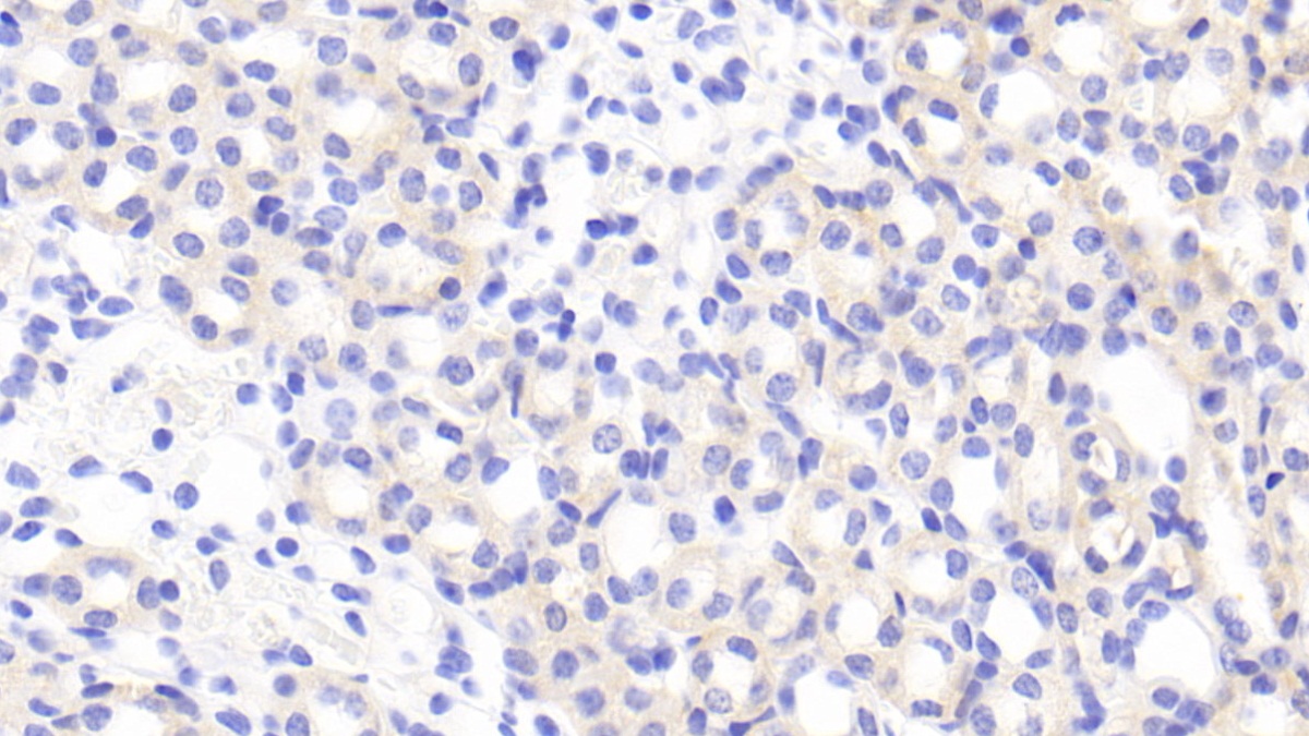 Polyclonal Antibody to A Disintegrin And Metalloproteinase With Thrombospondin 2 (ADAMTS2)