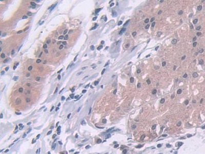 Polyclonal Antibody to A Disintegrin And Metalloproteinase With Thrombospondin 10 (ADAMTS10)