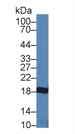 Polyclonal Antibody to Non Metastatic Cells 3, Protein NM23A Expressed In (NME3)