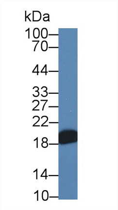 Polyclonal Antibody to Non Metastatic Cells 3, Protein NM23A Expressed In (NME3)