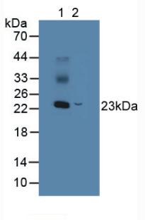 Polyclonal Antibody to Non Metastatic Cells 5, Protein NM23A Expressed In (NME5)