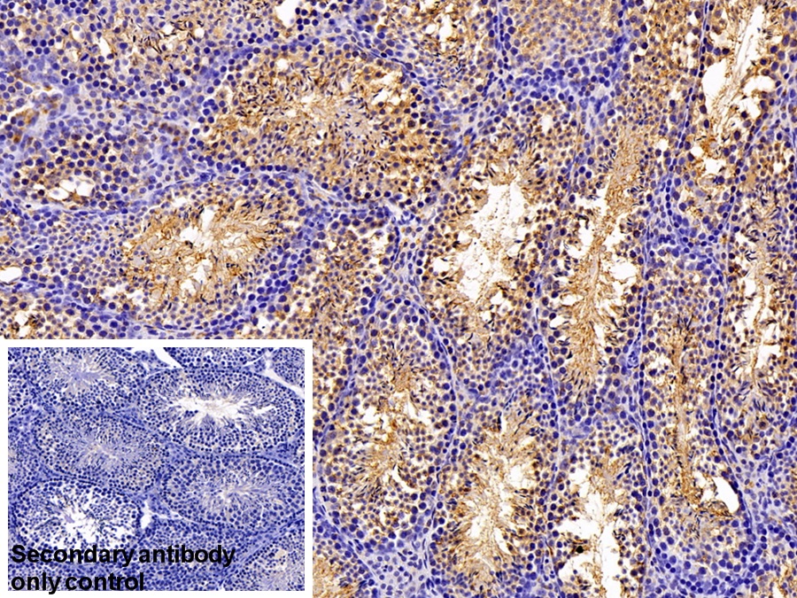 Polyclonal Antibody to Non Metastatic Cells 5, Protein NM23A Expressed In (NME5)