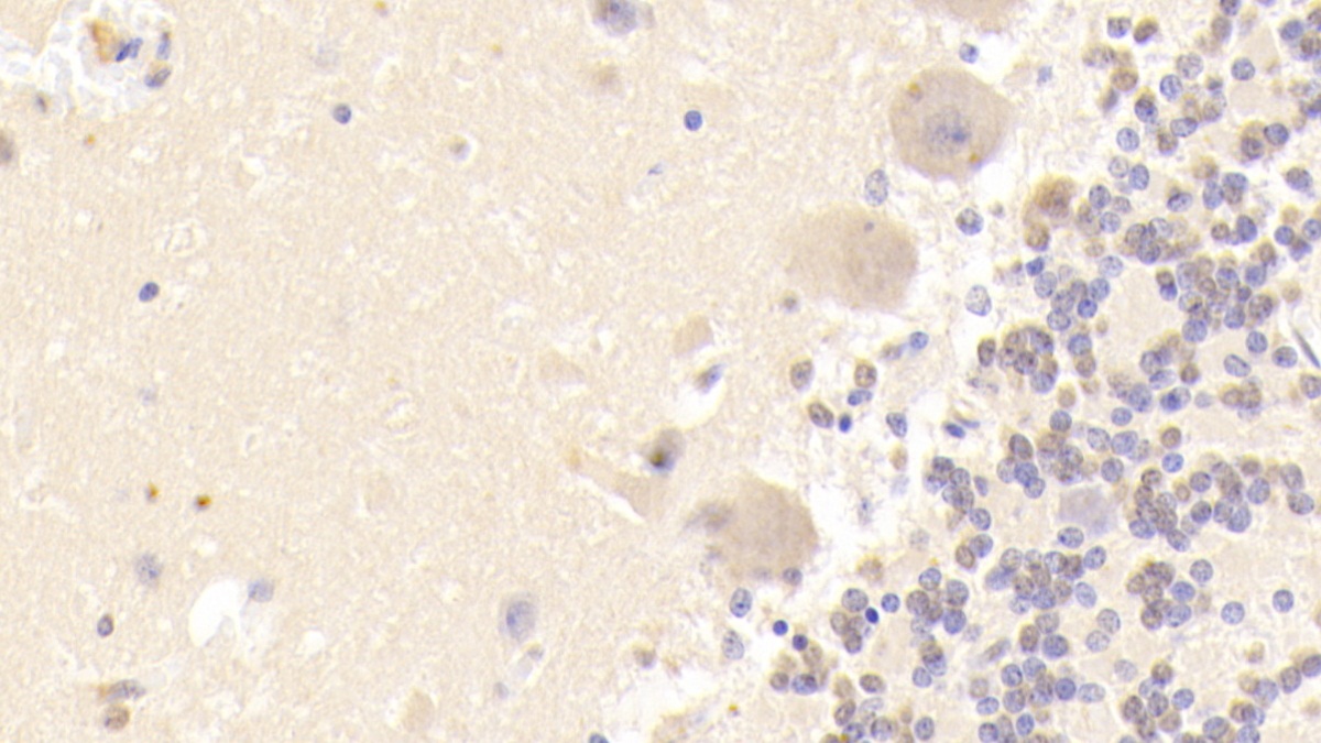 Polyclonal Antibody to FYN Oncogene Related To SRC/FGR/YES (FYN)