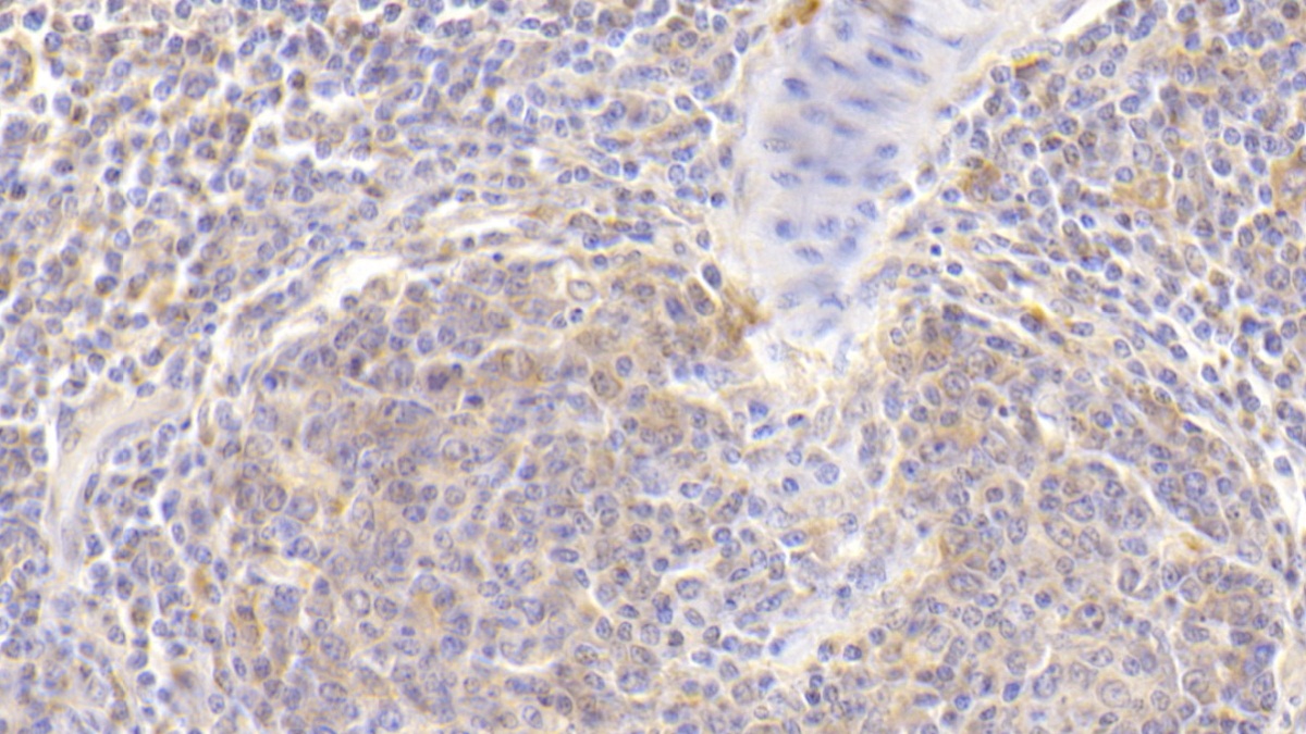 Polyclonal Antibody to FYN Oncogene Related To SRC/FGR/YES (FYN)