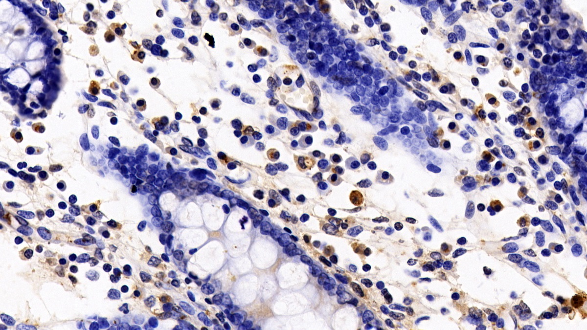 Polyclonal Antibody to FYN Oncogene Related To SRC/FGR/YES (FYN)