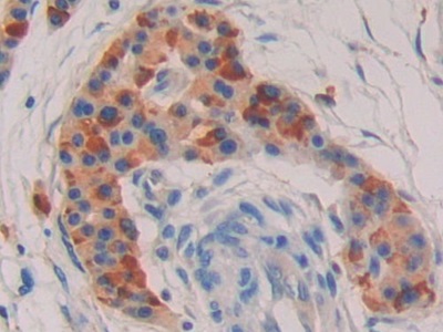 Polyclonal Antibody to Nucleotide Binding Oligomerization Domain Containing Protein 1 (NOD1)