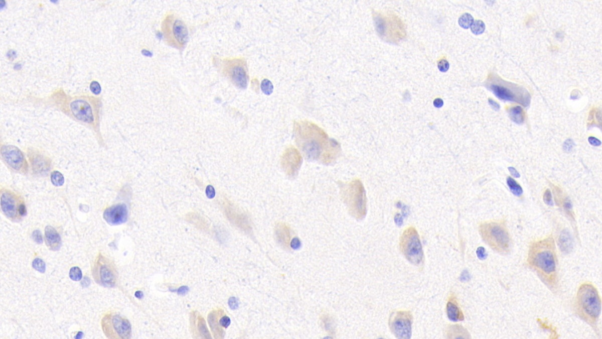 Polyclonal Antibody to RAB5A, Member RAS Oncogene Family (RAB5A)