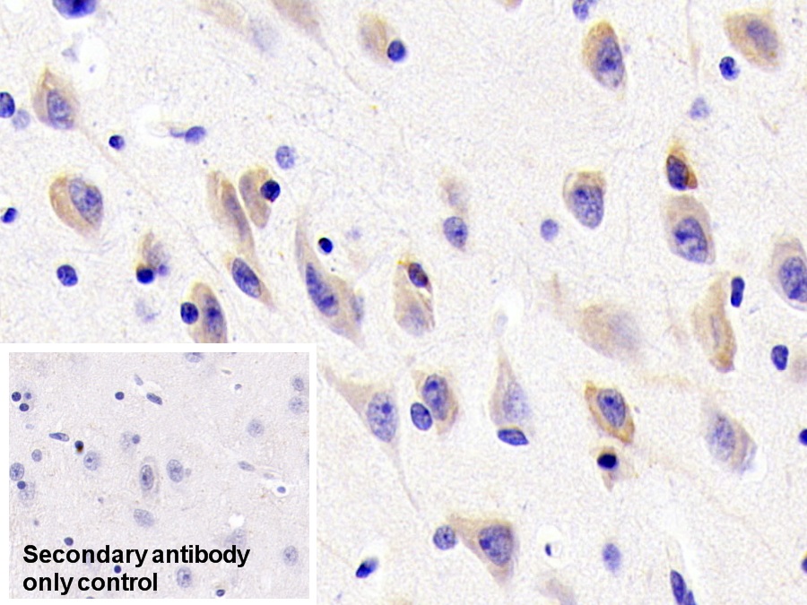 Polyclonal Antibody to RAB5A, Member RAS Oncogene Family (RAB5A)