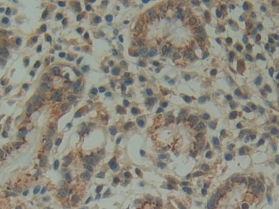 Polyclonal Antibody to Family With Sequence Similarity 3, Member D (FAM3D)