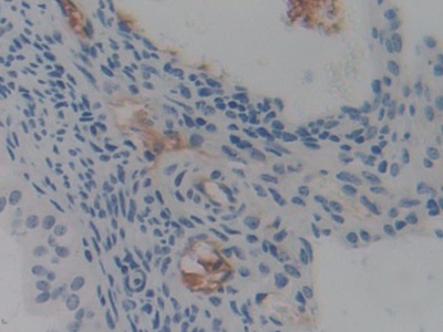 Polyclonal Antibody to Pentraxin 3, Long (PTX3)