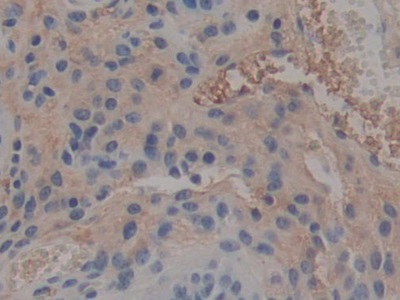 Polyclonal Antibody to Pentraxin 3, Long (PTX3)